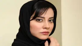 چهره خانم بازیگر پس از عمل جراحی/ عکس
