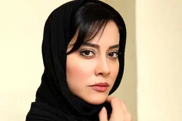 چهره خانم بازیگر پس از عمل جراحی/ عکس
