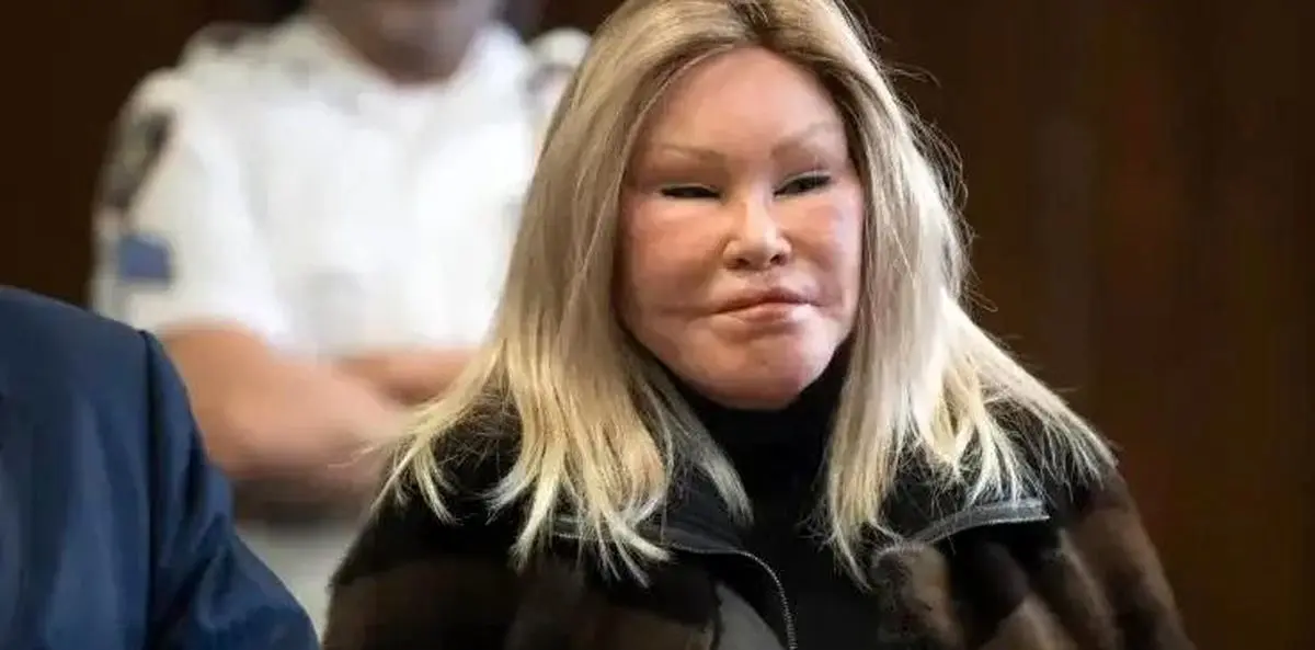 زن گربه‌ای جهان درگذشت
