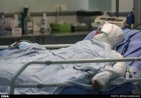 تصاویر دلخراش صداوسیما از حوادث اسیدپاشی