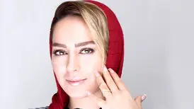 سمانه پاکدل: من جز بوتاکس و لمینت کار زیبایی انجام ندادم