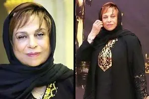 ناگفته های گوهر خیراندیش از وِیژگی خاص شخصیتی ترانه علیدوستی تا عمل بینی/ همسرم گفت گوهر را نمی‌توانید زشت کنید!