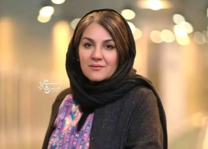 تغییر چهره ستاره اسکندری پس از ۱۹ سال