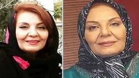 ابتلای بازیگر زن مشهور سینما به سرطان

