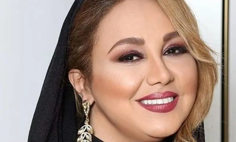 تغییر چهره عجیب بهنوش بختیاری سوژه فضای مجازی شد
