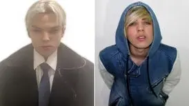 سلبریتی ۲۲ ساله کانادایی پس از ۱۲ عمل جراحی زیبایی درگذشت
