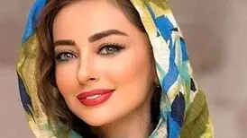 “نفیسه روشن” مورد ضرب و شتم و خشونت خانگی قرار گرفت! + عکس دست کبود وی