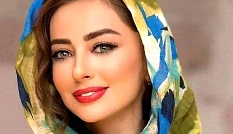 “نفیسه روشن” مورد ضرب و شتم و خشونت خانگی قرار گرفت! + عکس دست کبود وی