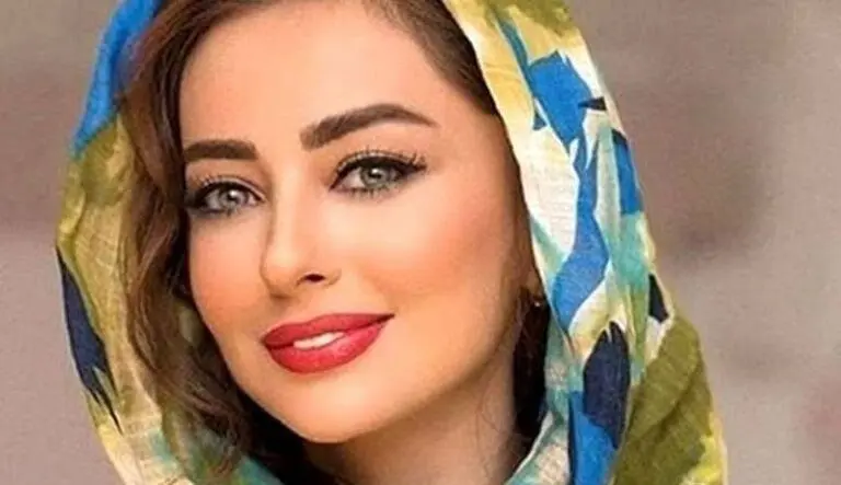 “نفیسه روشن” مورد ضرب و شتم و خشونت خانگی قرار گرفت! + عکس دست کبود وی