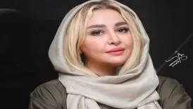 چهره متفاوت مه‌لقا باقری بعد از عمل زیبایی
