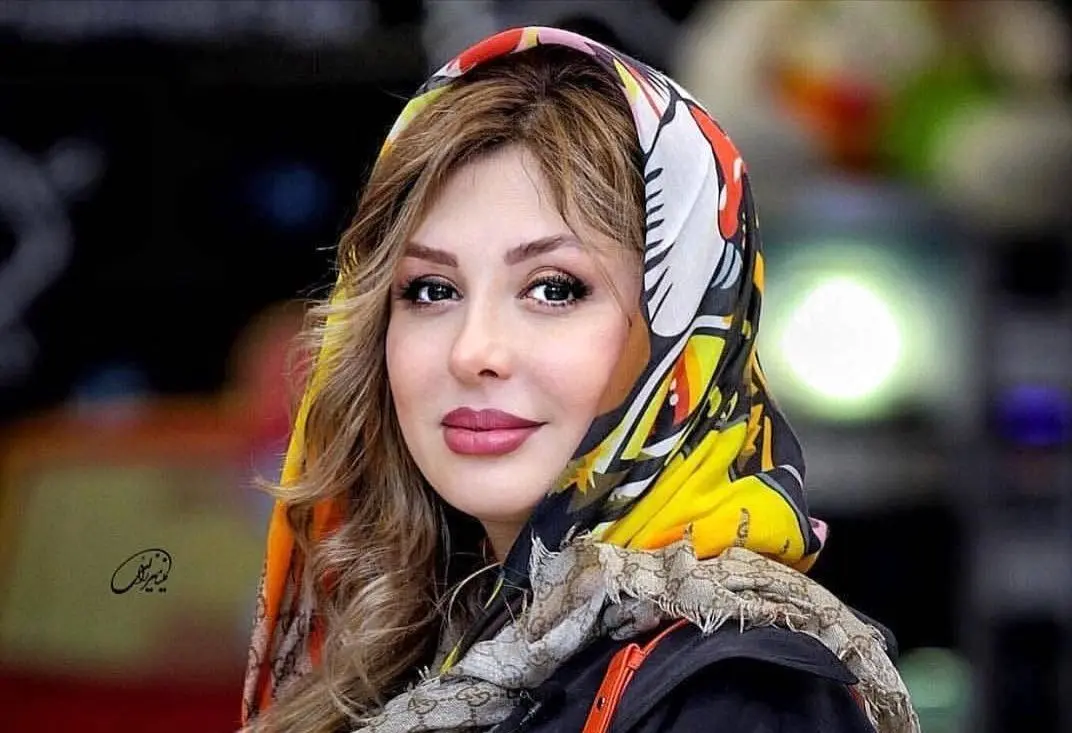 نیوشا ضیغمی از بینی جدیدش رونمایی کرد