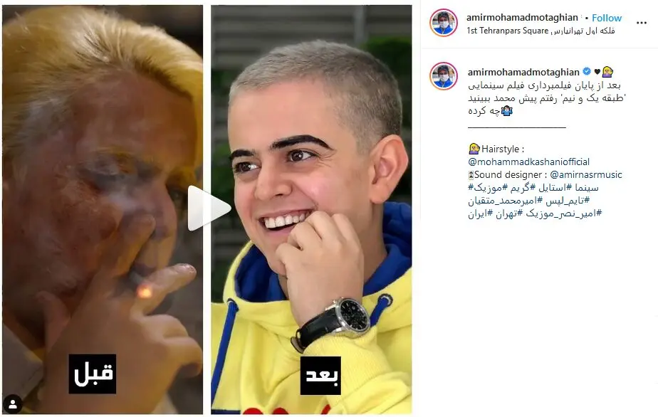 تغییر چهره عجیب امیرمحمدِ عموپورنگ بعد از بازی در یک فیلم سینمایی/ ویدئو