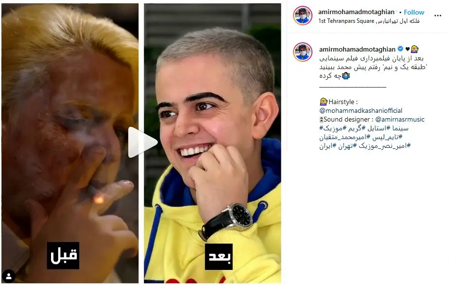 تغییر چهره عجیب امیرمحمدِ عموپورنگ بعد از بازی در یک فیلم سینمایی/ ویدئو