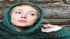 چهره عروسکی شهره قمر از نمایی نزدیک؛ عمل های زیبایی اش نمایان شد !
