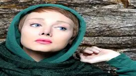 چهره عروسکی شهره قمر از نمایی نزدیک؛ عمل های زیبایی اش نمایان شد !
