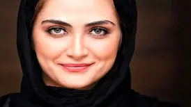 تغییر چهره جذاب سیما بازیگر سریال زخم کاری