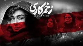 سکانس عجیب و غریب از سریال زخم کاری