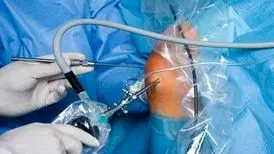 اقداماتی که باید پس از عمل آرتروسکوپی انجام داد!