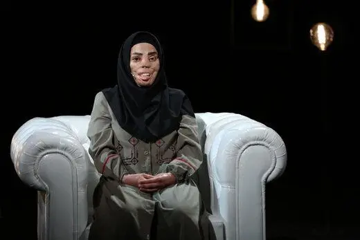 وقتی عروس خانواده روی صورت خواهرشوهر اسید پاشید!