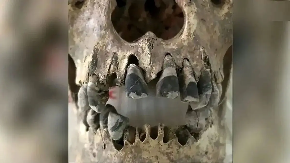 رسم عجیب سیاه کردن دندان در ویتنام