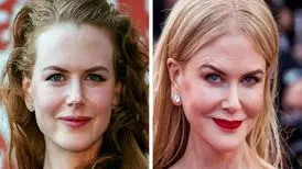 زنان سلبریتی که از عمل های زیبایی خود پشیمان شدند