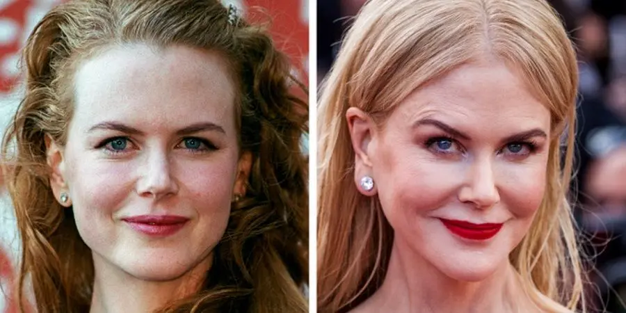 زنان سلبریتی که از عمل های زیبایی خود پشیمان شدند