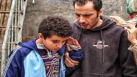 تغییر چهره ناگهانی آقای بازیگر