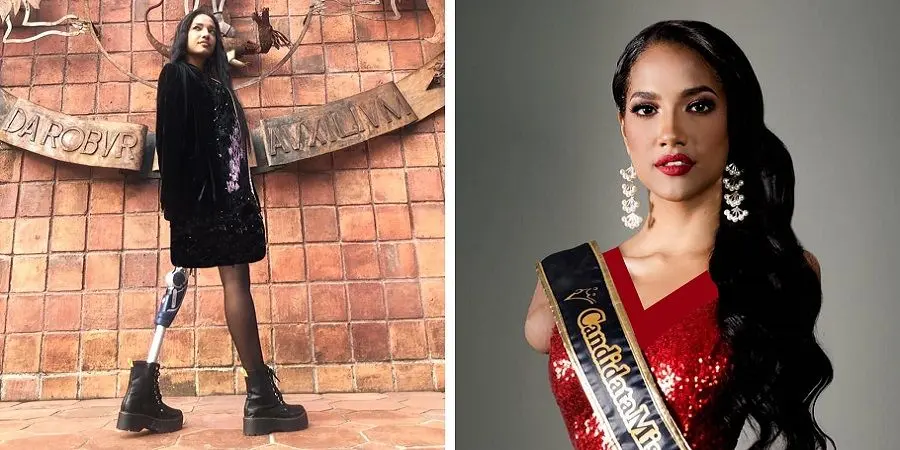 مدل زیبای اکوادوری که دست ها و یک پای خود را از دست داده است
