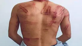 وضعیت یک عکاس پس از آزادی از بازداشت طالبان
