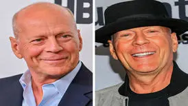 ۱۰ سلبریتی مشهور که به بیماری نادر مبتلا هستند