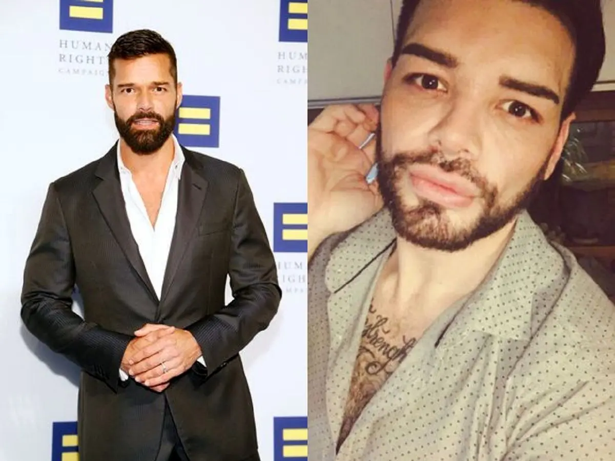 مردی که با ۳۰ عمل زیبایی خودش را شبیه ریکی مارتین، خواننده معروف، کرده است