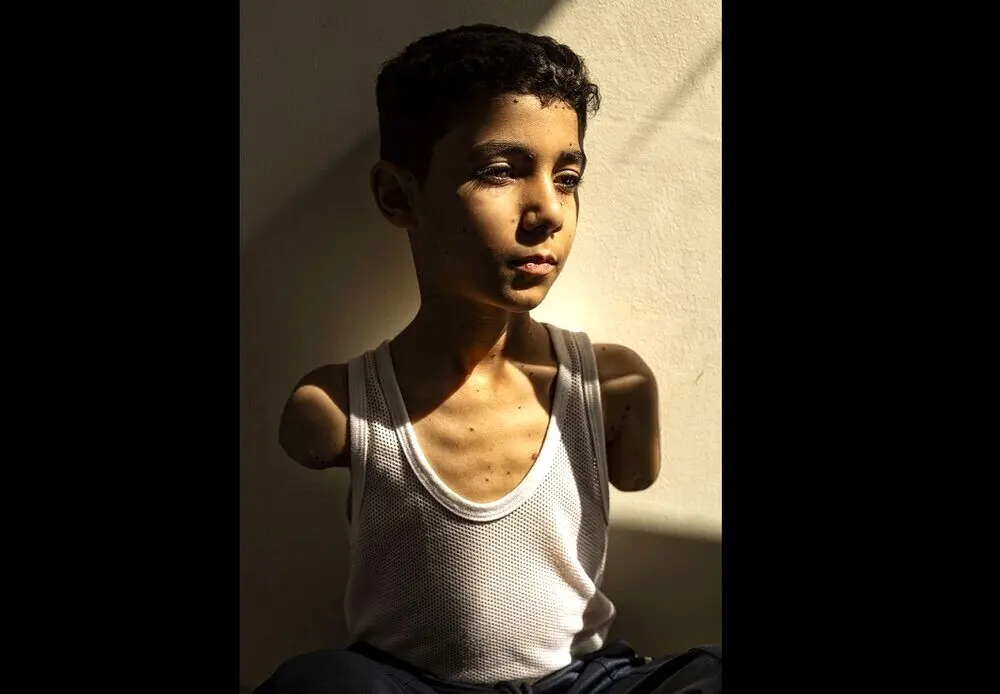 عکس کودک فلسطینی، برنده ورلدپرس ۲۰۲۵ شد