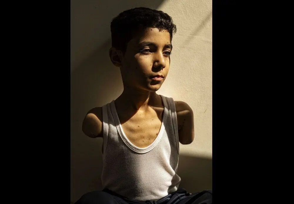 عکس کودک فلسطینی، برنده ورلدپرس ۲۰۲۵ شد