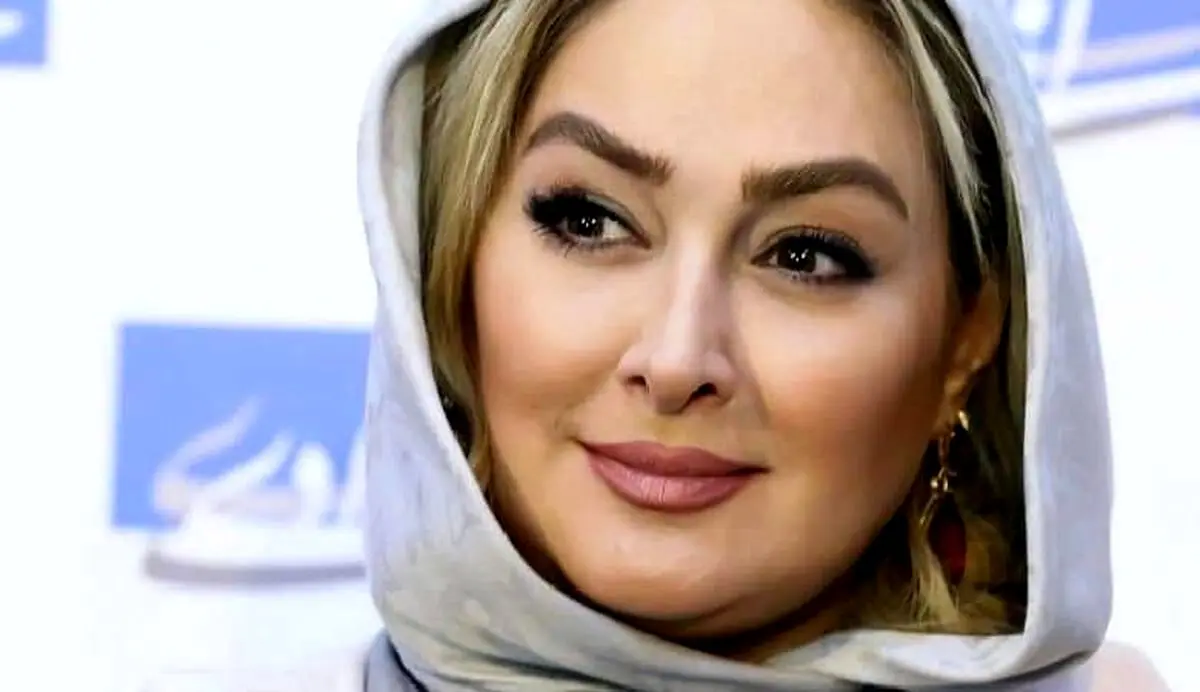 پوشش متفاوت الهام حمیدی
