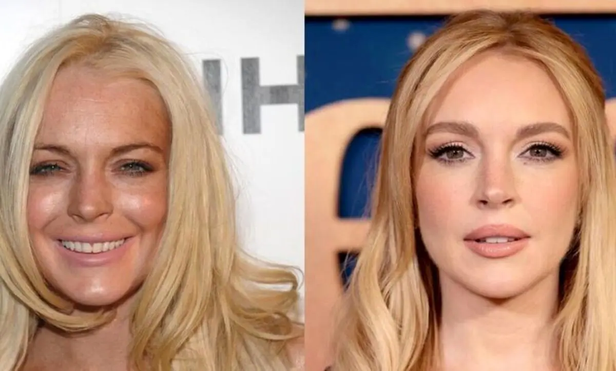 تغییر چهره عجیب بازیگر زن سینما؛ جراحی زیبایی یا فقط رژیم غذایی؟
