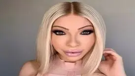 این زن بعد از هزینه ۵۰ هزار دلاری برای جراحی زیبایی، حالا پشیمان شده!
