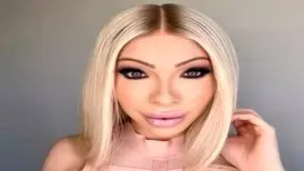 این زن بعد از هزینه ۵۰ هزار دلاری برای جراحی زیبایی، حالا پشیمان شده!
