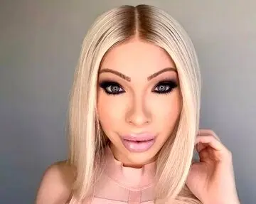 این زن بعد از هزینه ۵۰ هزار دلاری برای جراحی زیبایی، حالا پشیمان شده!
