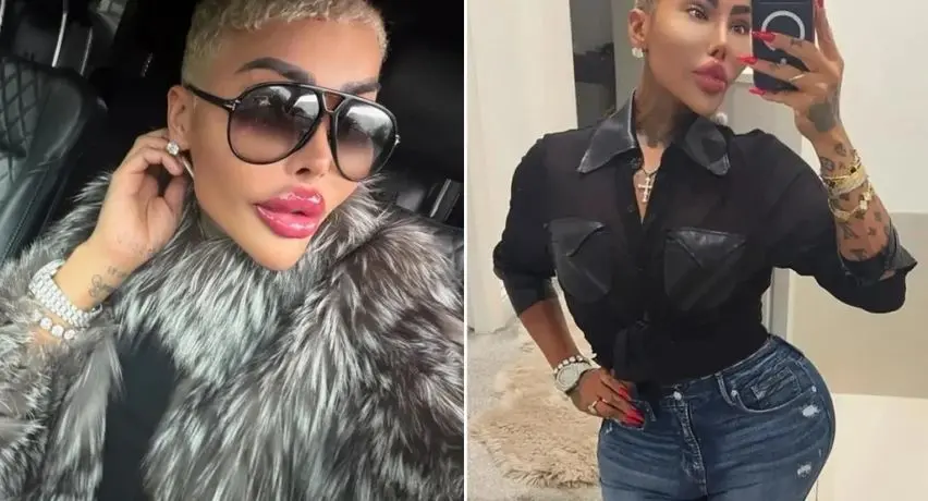 مرگ مشکوک زن شیفته کیم کارداشیان ملقب به «سلطان لب» 