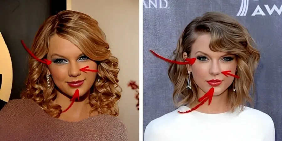 لو رفتن عمل های زیبایی چند چهره مشهور؛ از تیلور سوییفت تا دیوید بکهام
