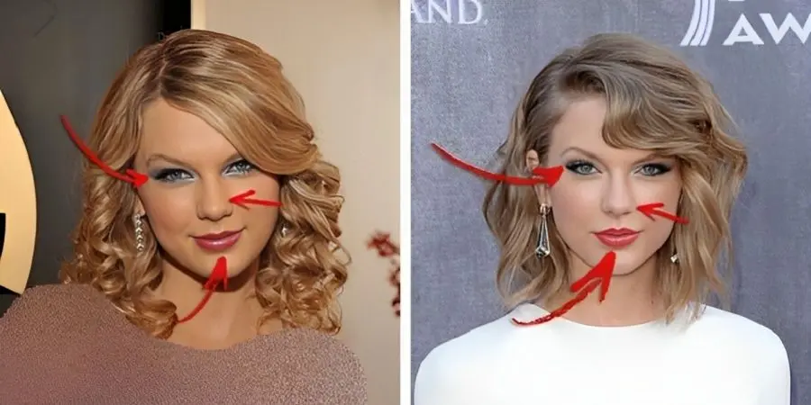 لو رفتن عمل های زیبایی چند چهره مشهور؛ از تیلور سوییفت تا دیوید بکهام
